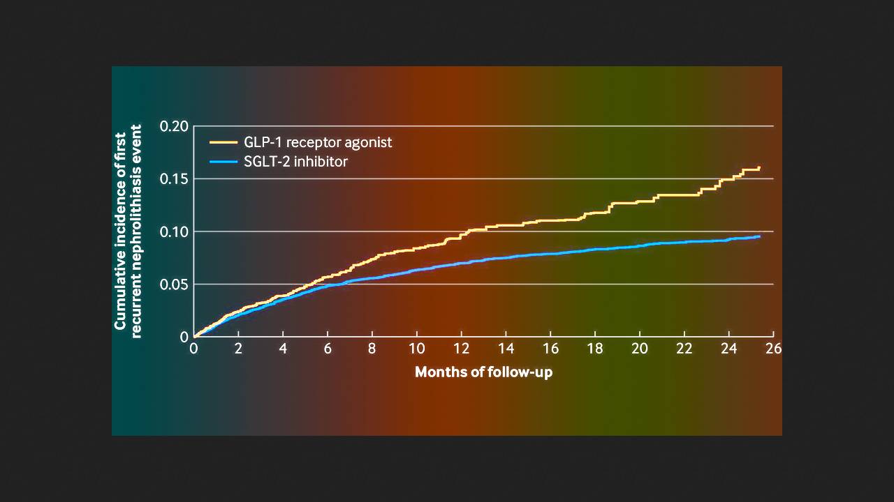 Глифлозины лучше агонистов ГПП-1 защитили от повторного нефролитиаза при диабете
