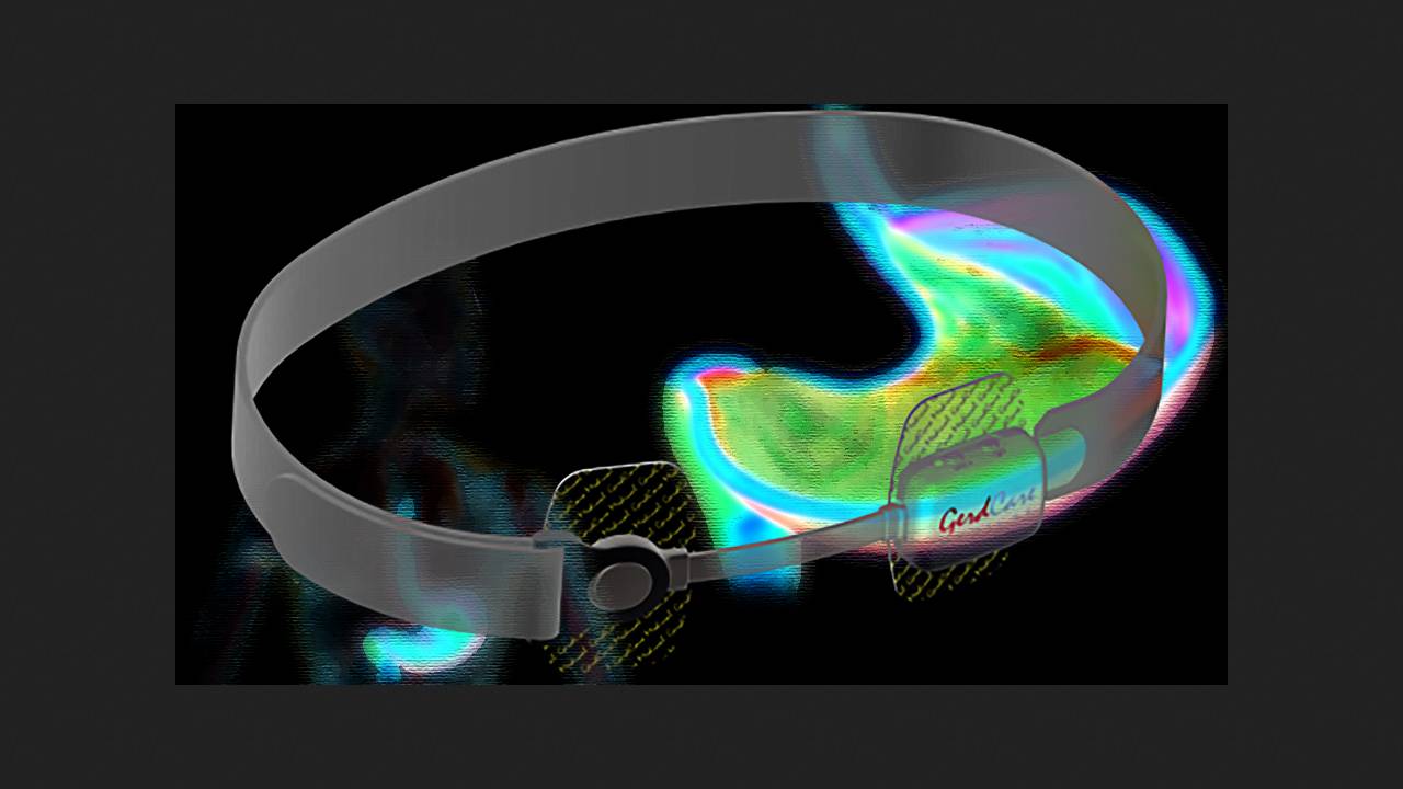 Черезшкірна електростимуляція допомогла при гастроезофагеальному рефлюксі