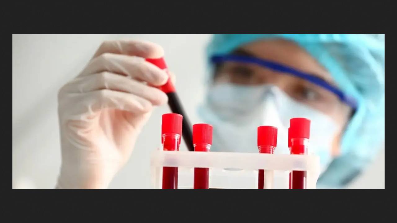 First Blood Test for Alzheimer's Disease Approved