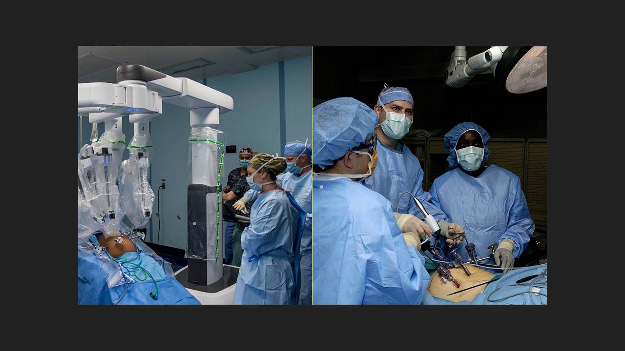 Robotic gallbladder removal gives way to laparoscopic
