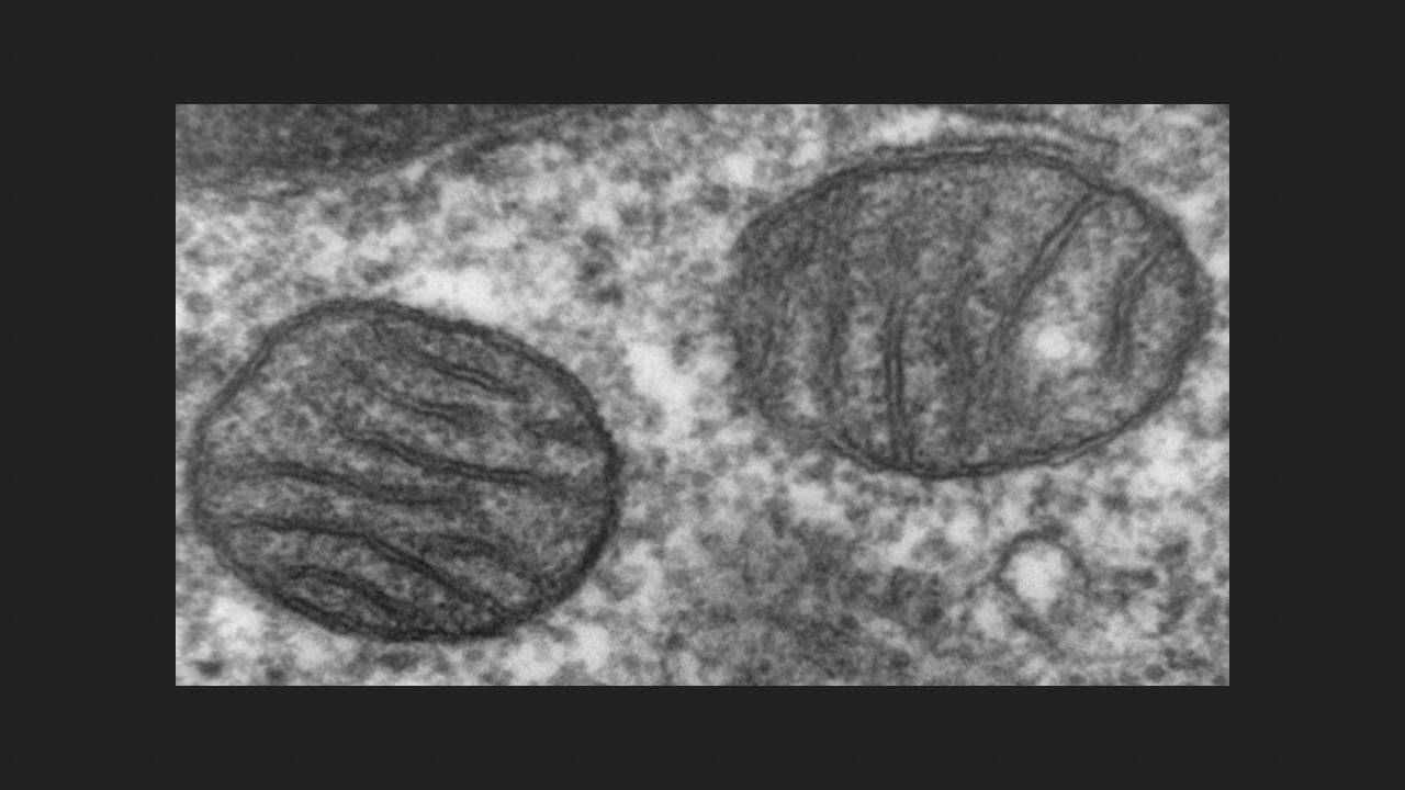 Proteomics could help identify mitochondrial diseases in newborns