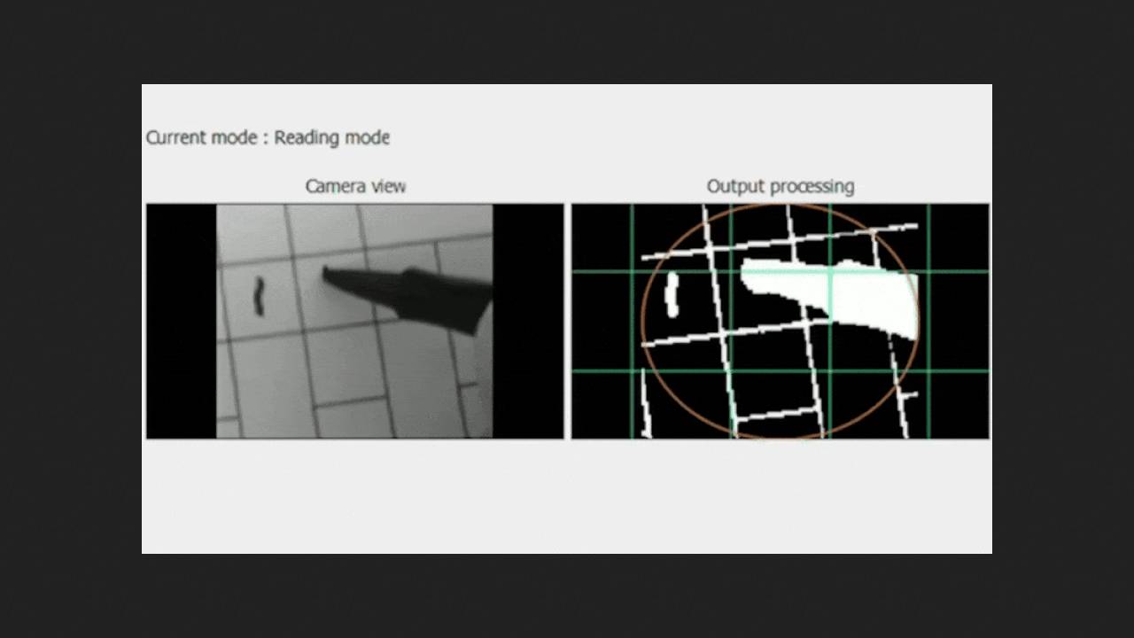 Photoelectric implant improves vision in patients with age-related macular degeneration