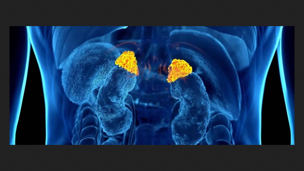 ИИ видит хронический стресс на КТ