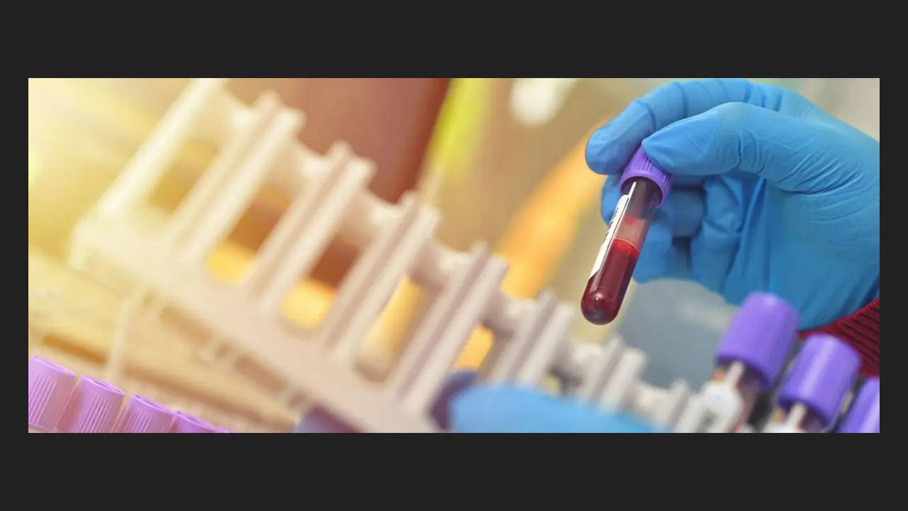 Blood test increases the accuracy of early-stage Alzheimer's disease diagnosis to 95%